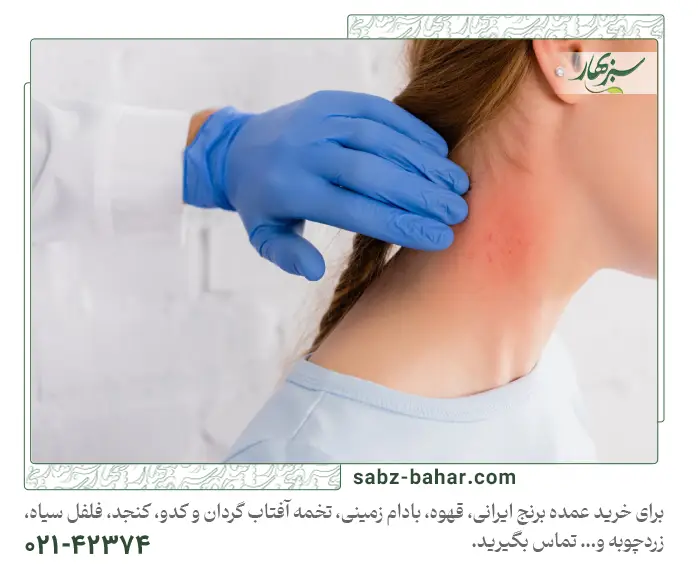 آیا تخمه آفتابگردان حساسیت‌زاست؟